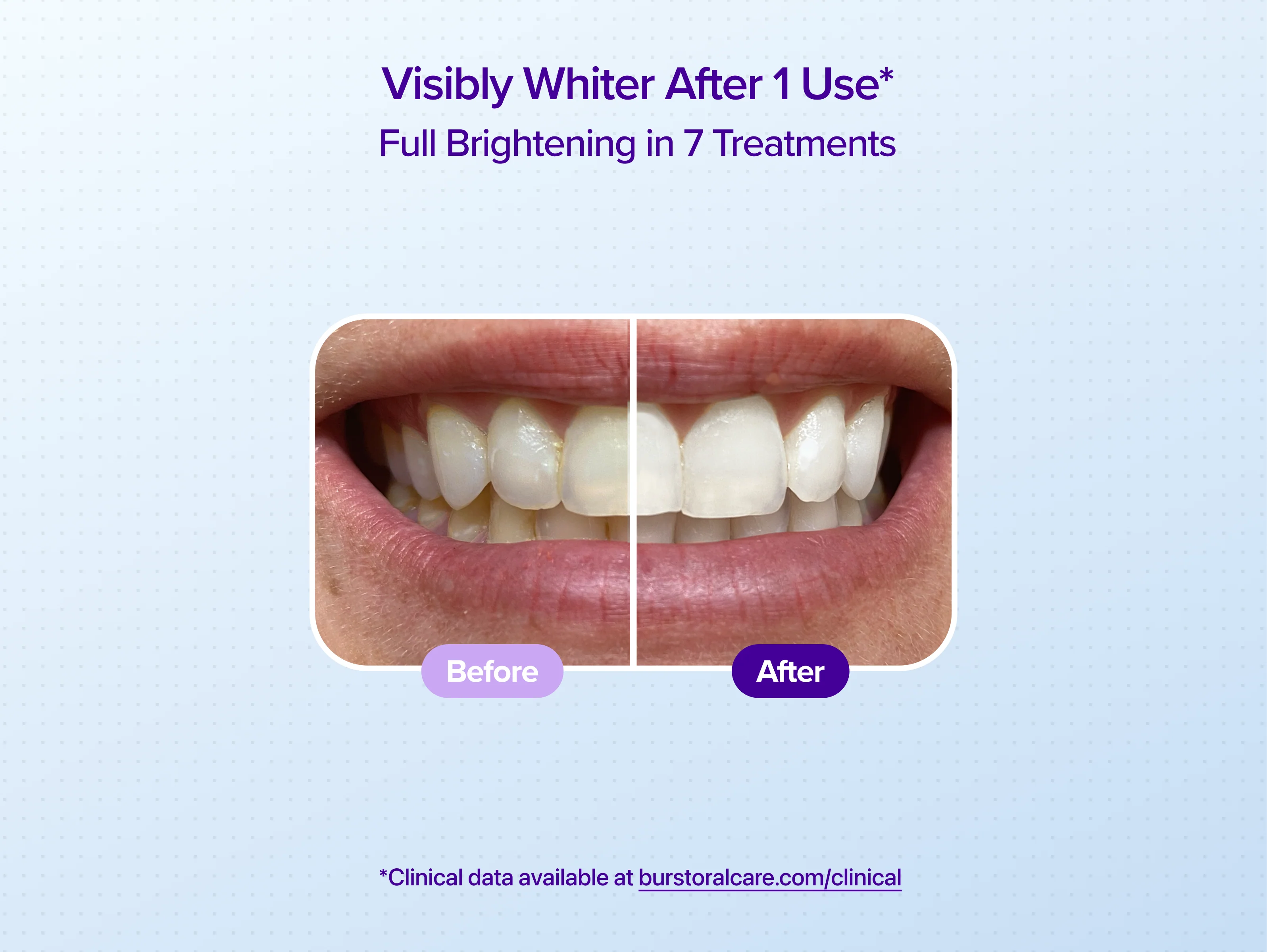 Mint Non-Slip Whitening Strips - Image 3
