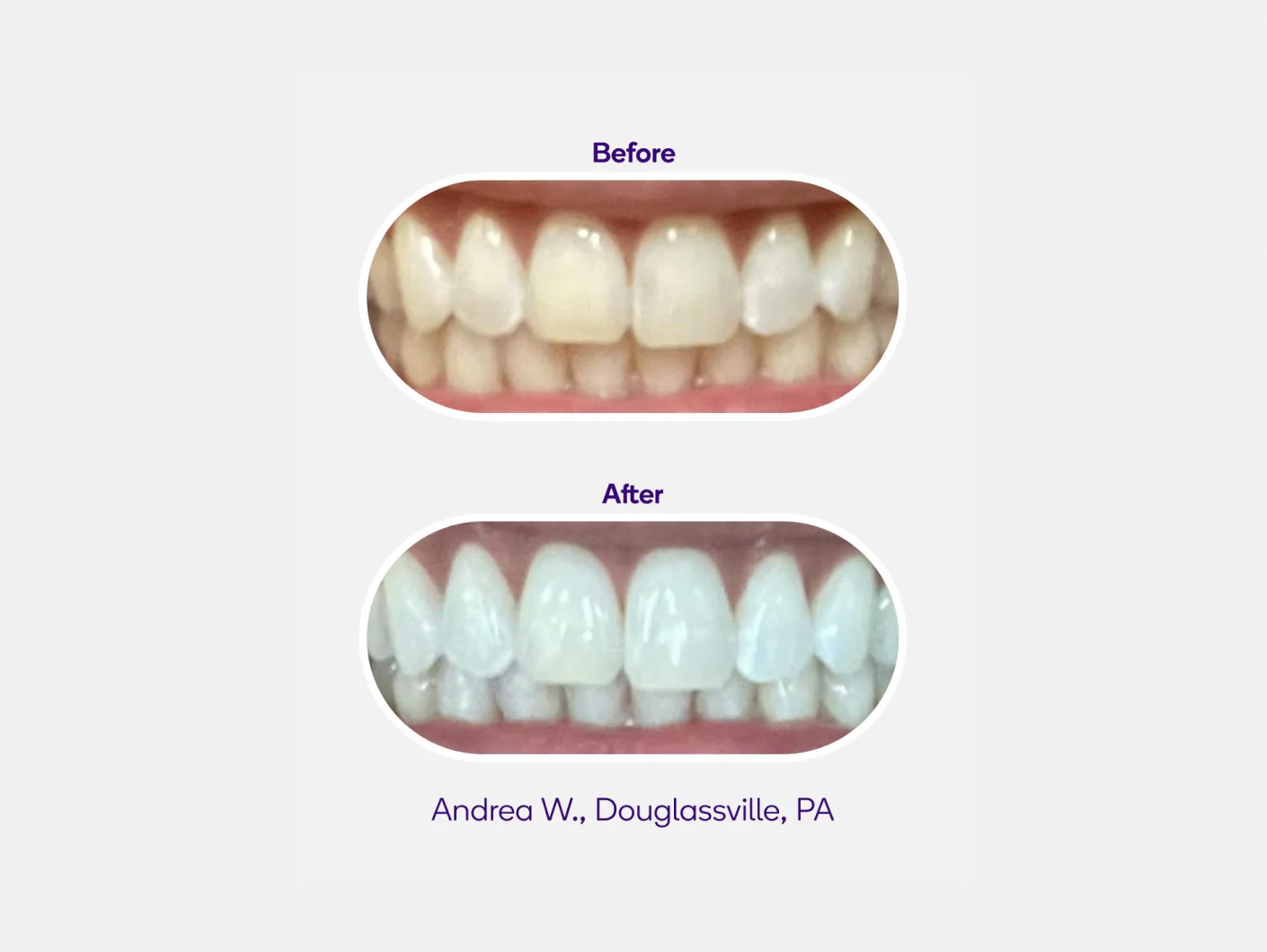 Mint Non-Slip Whitening Strips - Image 6