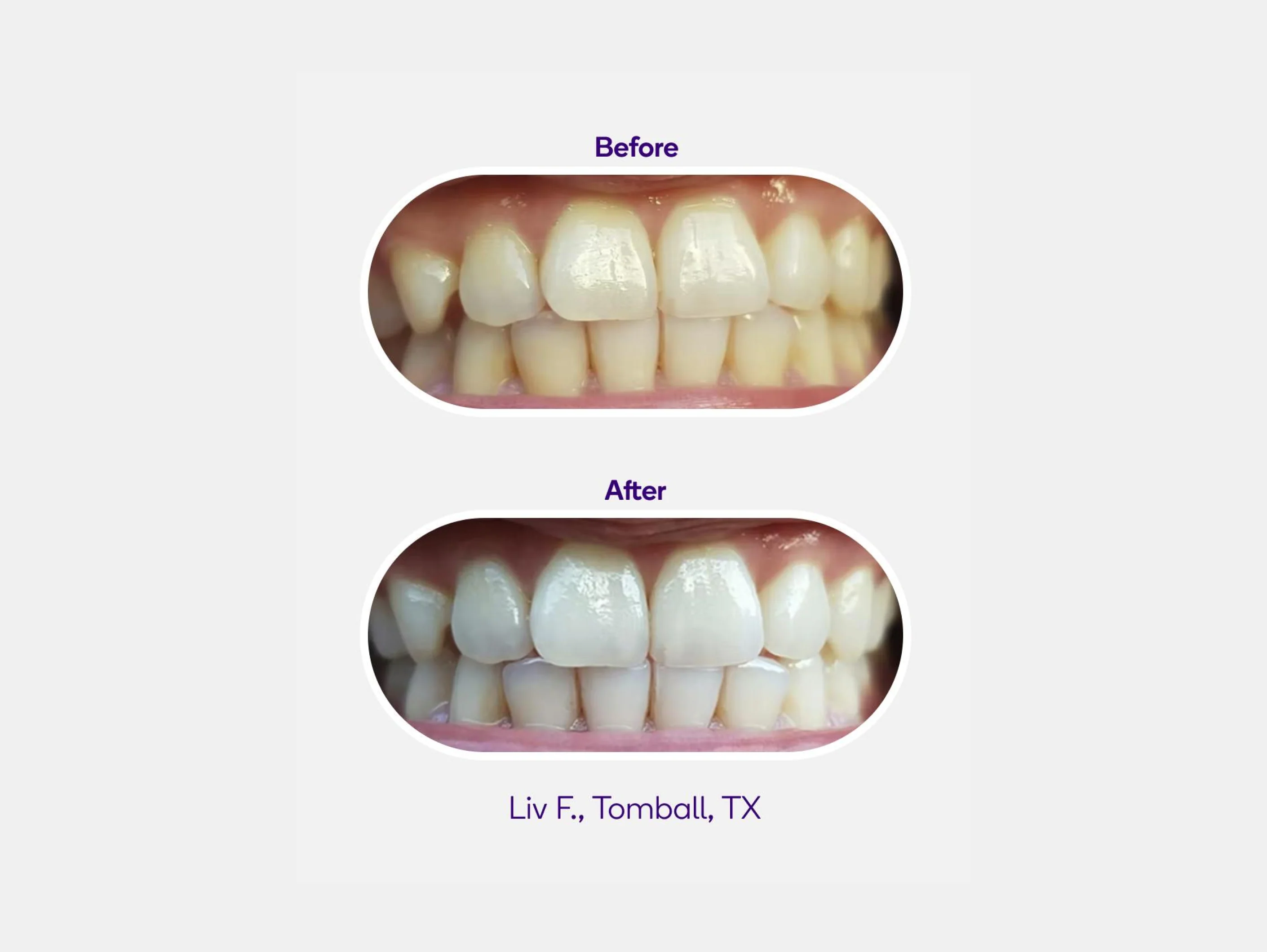 Mint Non-Slip Whitening Strips - Image 7