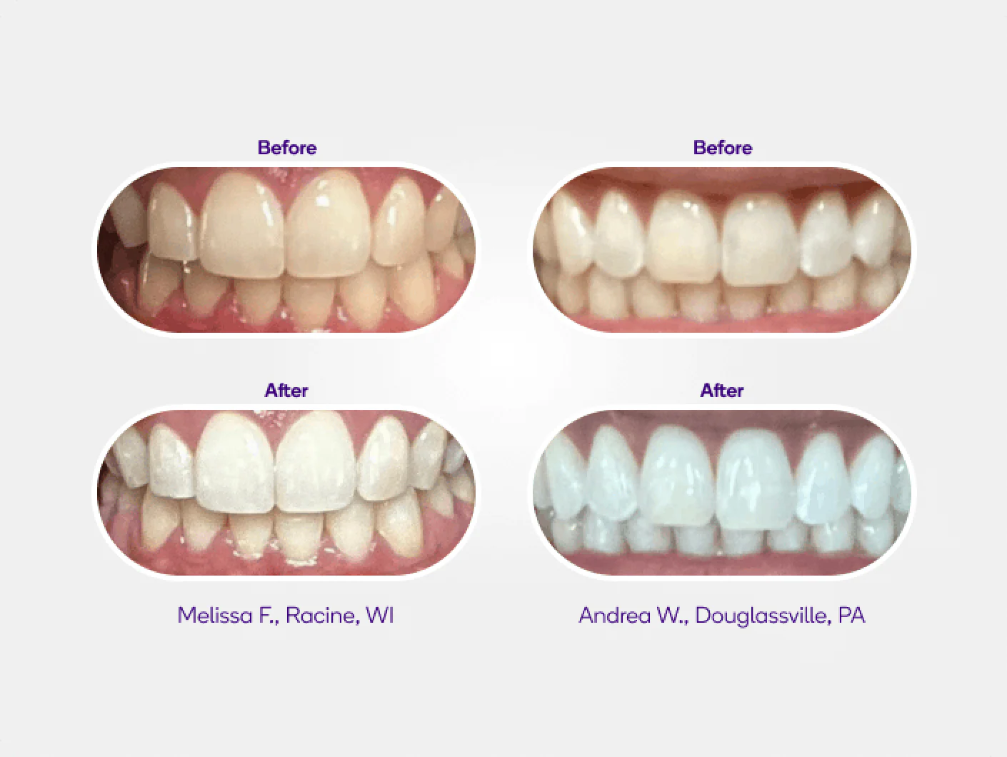 Mint Non-Slip Whitening Strips Refill - Image 4