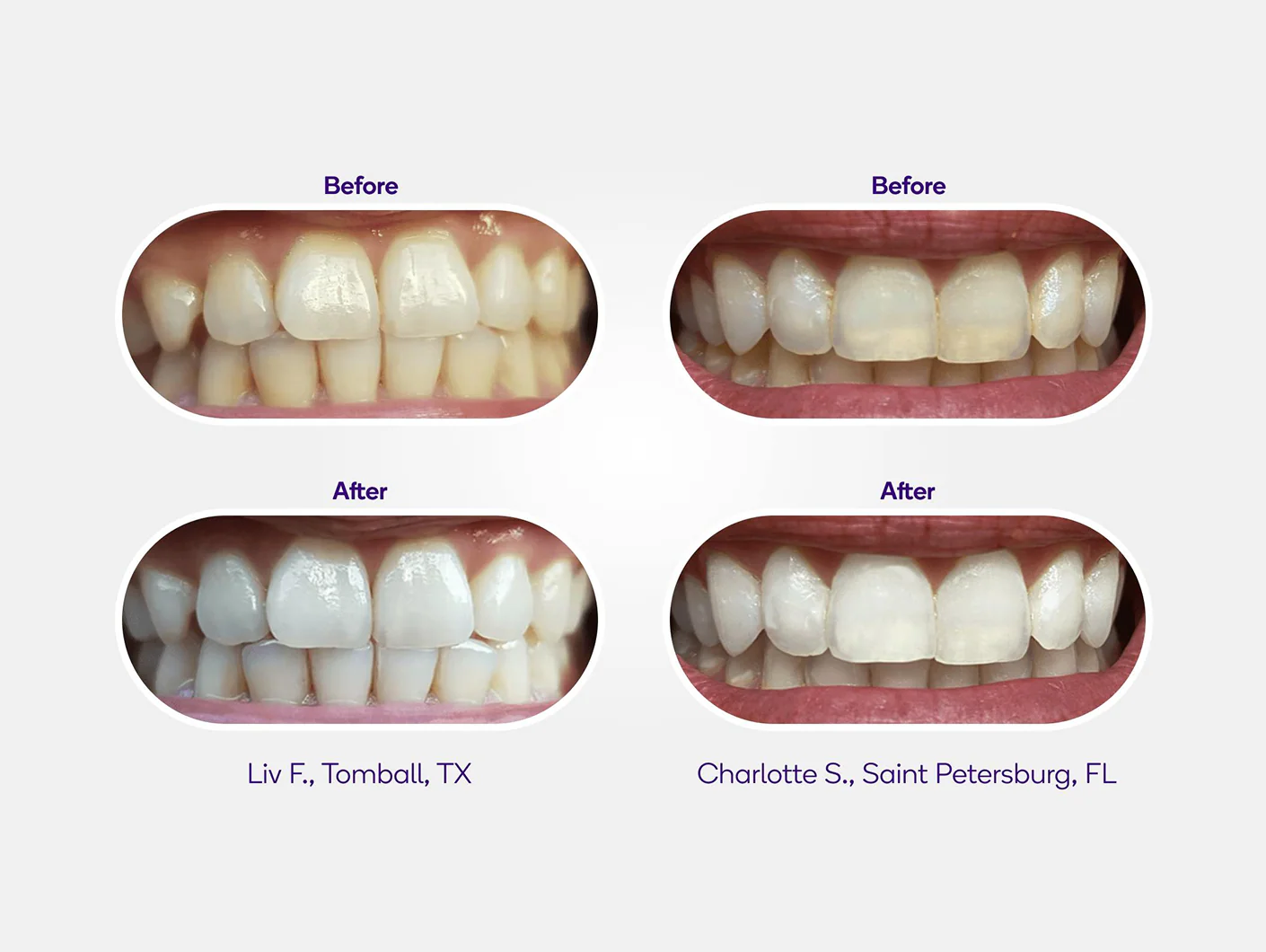 Non-Slip Whitening Strips (PAP) - Image 3