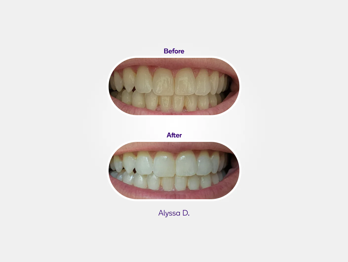 Precision Whitening Pen (PAP) - Image 3