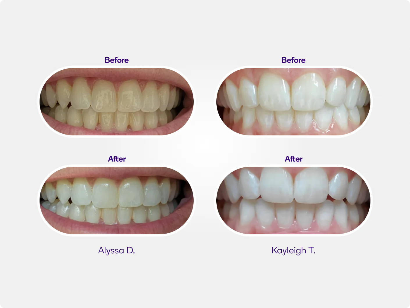 Precision Whitening Pen Refill - Image 3