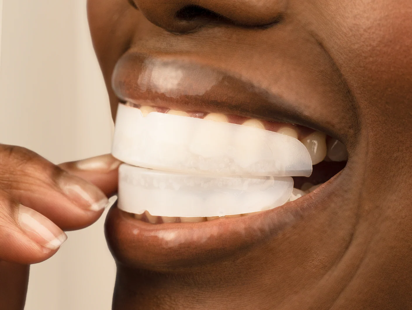 Prefilled Whitening Trays 3 pack Refill - Image 3